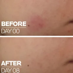 CICAPLAST B5 SÉRUM À 10% DE VITAMINE B5