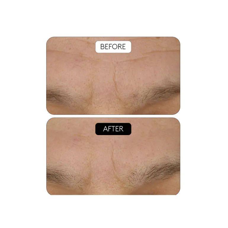 Clinical Beauty Filler