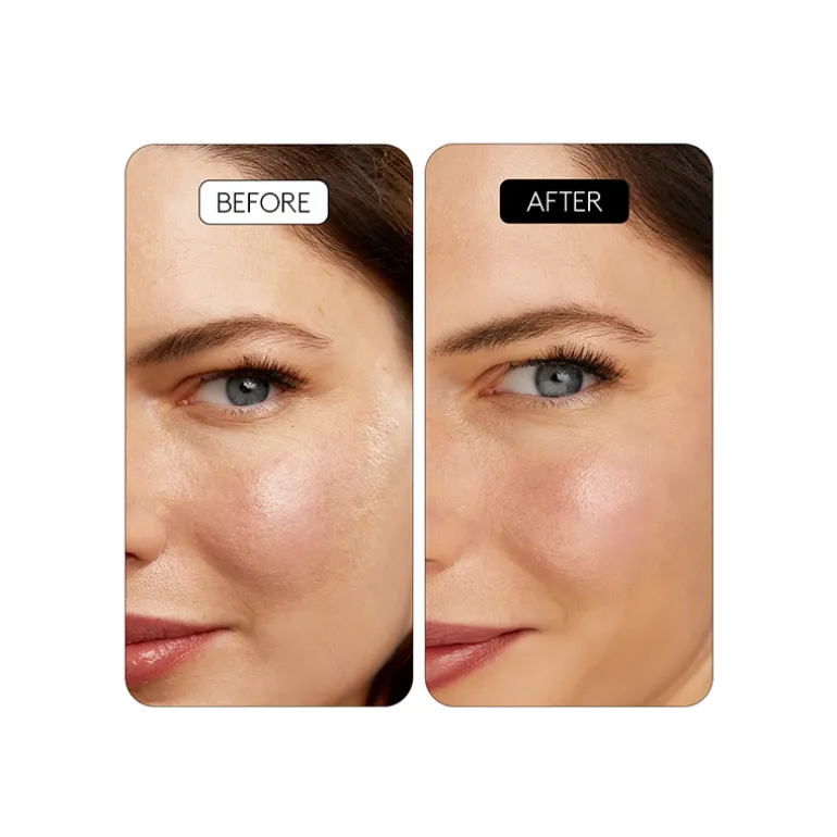 Clinical Retinal 0.1