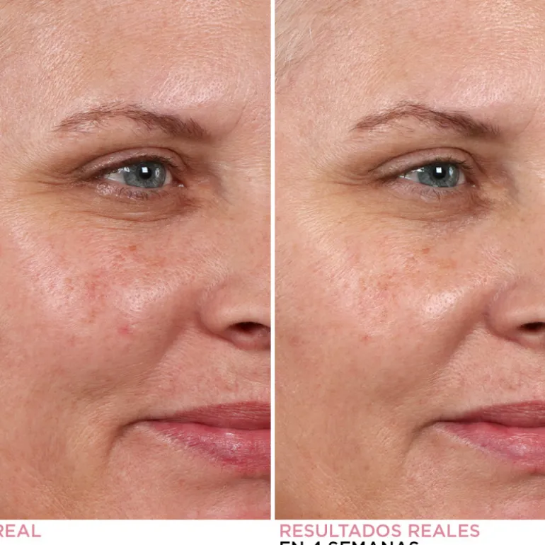 HELLO RESULTS BIPHASE PEEL 30ML
