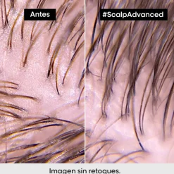 SCALP ADVANCED ANTI-OIL SHAMPOO