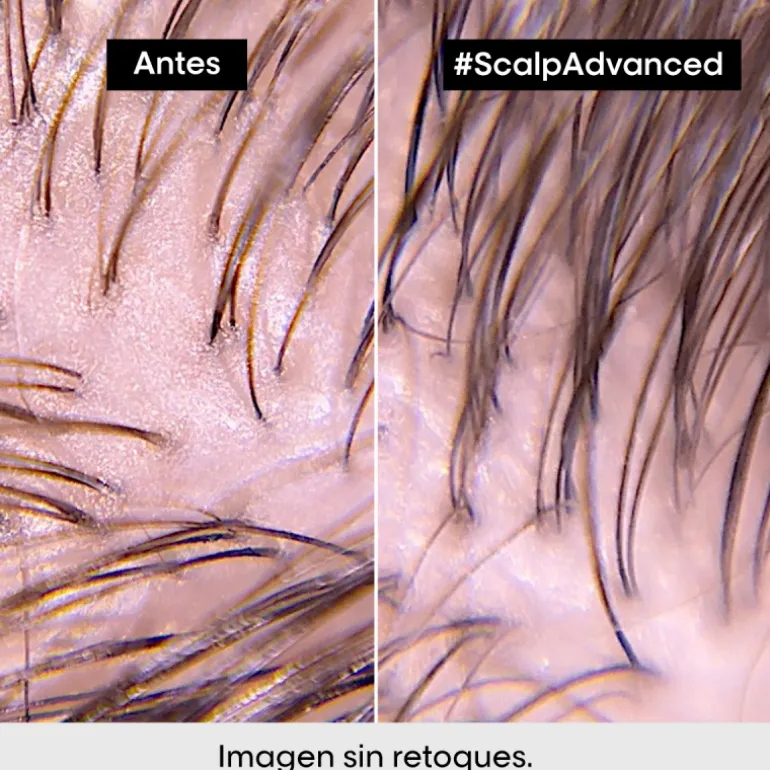 SCALP ADVANCED ANTI-OIL SHAMPOO