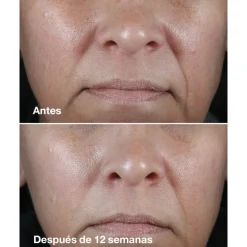 Smart Clinical Crème riche correctrice de rides 50ml