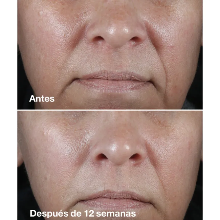 Smart Clinical Crème riche correctrice de rides 50ml