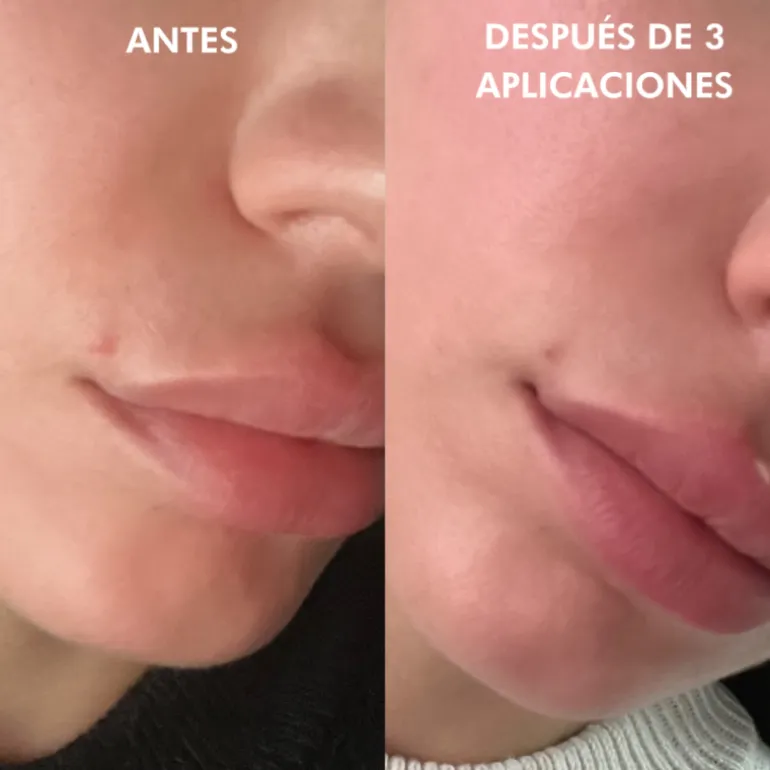 SOS Correction Stick