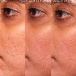 Sérum Anti-Imperfections Vinopure à l'Acide Salicylique