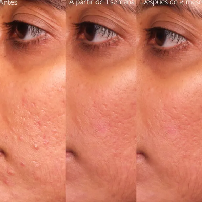 Sérum Anti-Imperfections Vinopure à l'Acide Salicylique