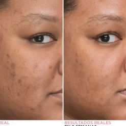 BYE BYE DARK SPOTS SERUM 30 ML