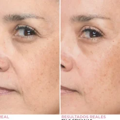 BYE BYE LINES SERUM 30 ML