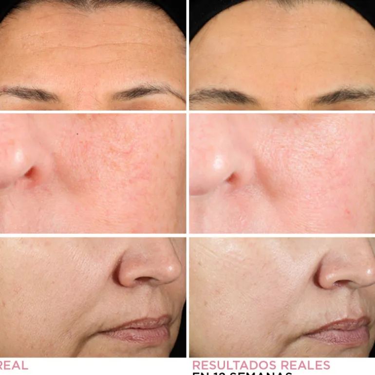 HELLO RESULTS PRSD RETINOL 50ML