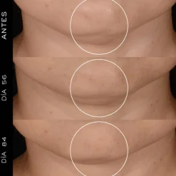 RÉNERGIE H.P.N. 300 -PEPTIDE CREAM REGENERATIVE ANTI-AGE CREAM LIMITED EDITION