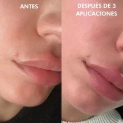 SOS Correction Stick