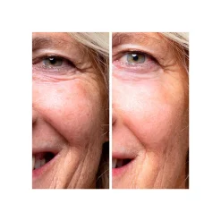 The Cure con Bakuchiol